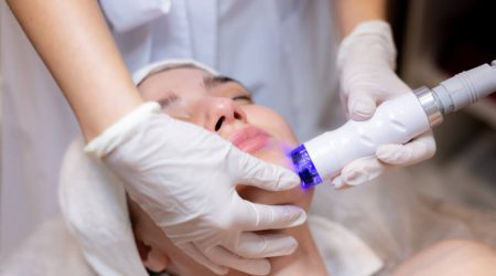 Depilación láser facial